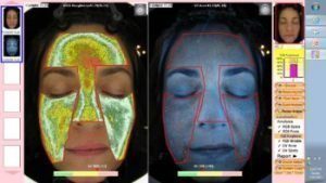 A woman's optic skin analysis