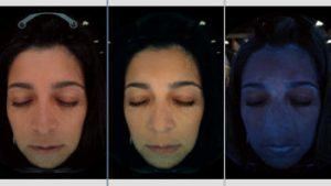 A woman's optic skin analysis