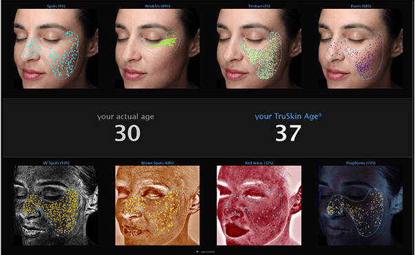 VISIA skin analysis